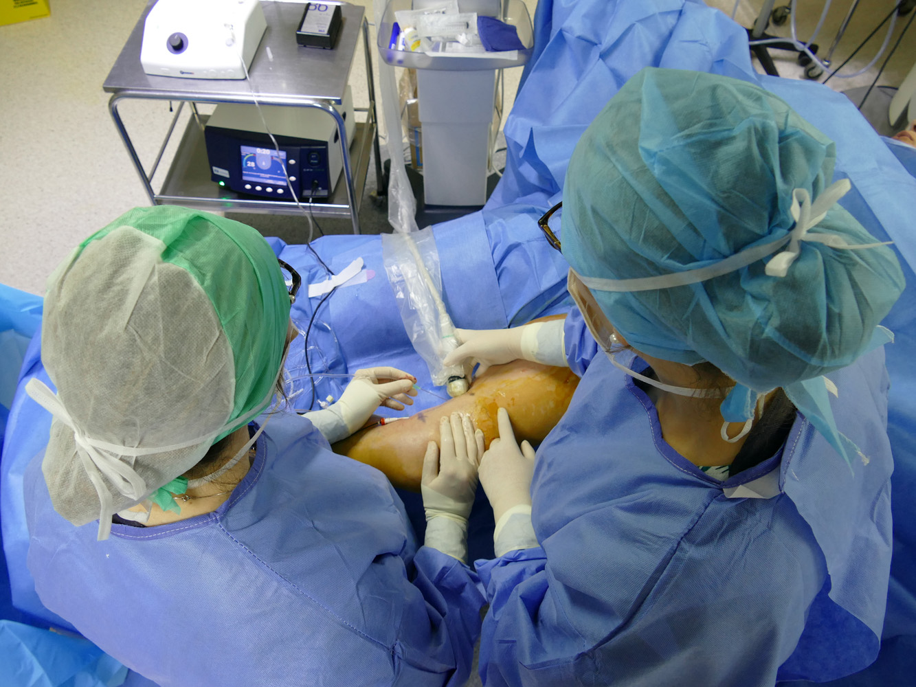 Varices et radiofréquence : le traitement proposé en ambulatoire au CHRU de Nancy