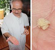 Les causes de la maladie Les causes de la maladie